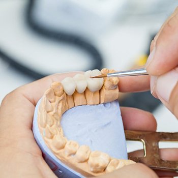 Dentist holding a dental bridge on a plaster model