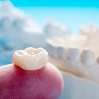 What Is a Dental Crown? (H2)
