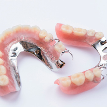 Model of partial denture