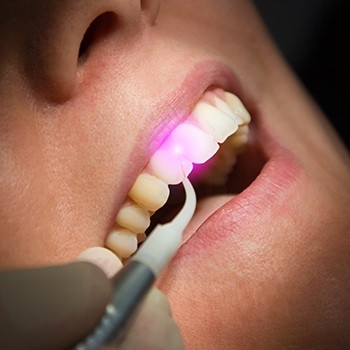 Patient receiving soft tissue laser gum treatment