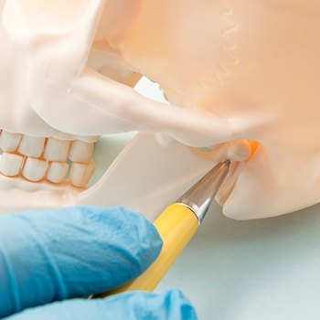 Skull and jawbone model for TMJ therapy planning