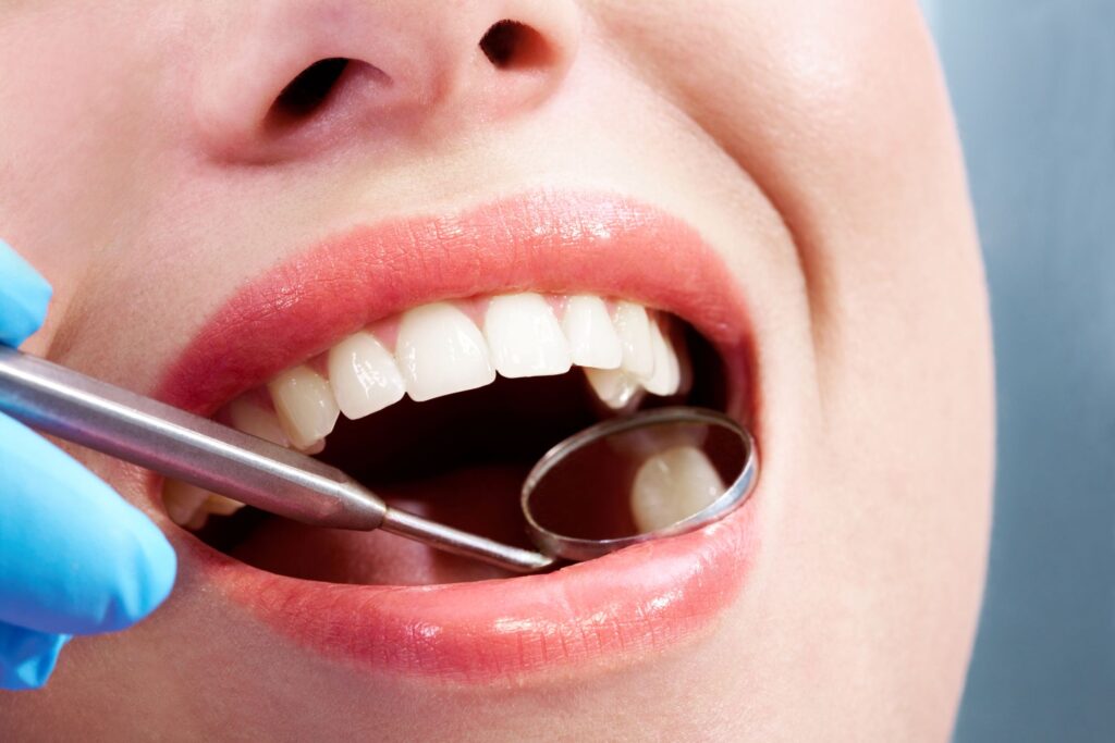 Closeup of dental mirror reflecting a woman's teeth during exam